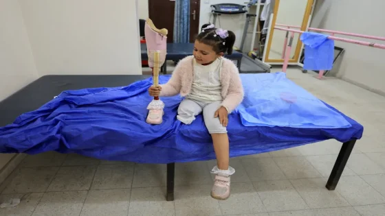 مبتورو الأطراف في قطاع غزة: جراح مفتوحة لا تلتئم