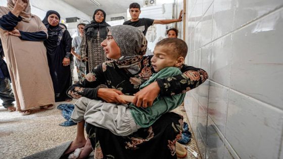 17 ألف طفل يعانون في سوء التغذية بغزة